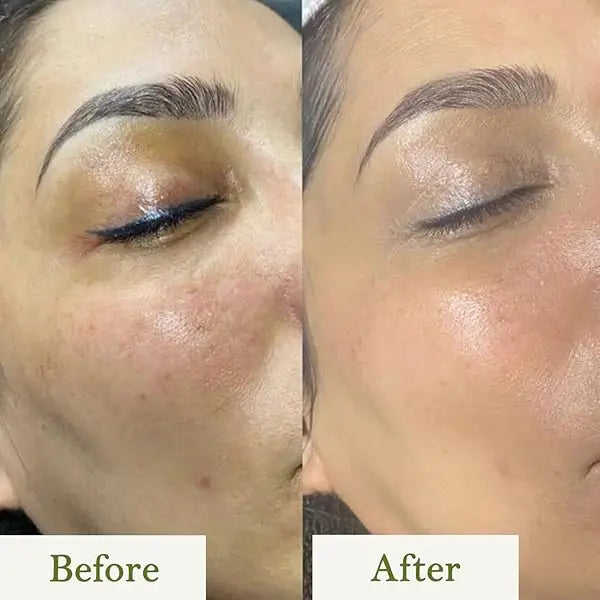 Aloe Vera Cleanser for Hydration My Store