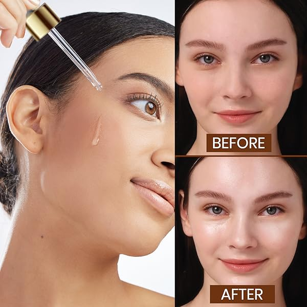 Hyaluronic Acid Serum | Deep Hydration, Fine Line Reduction My Store