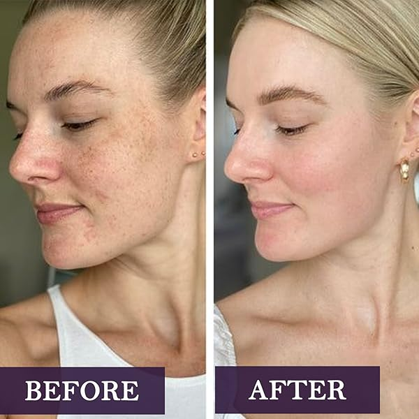 Retinol Cream | Targeting Wrinkles, Boosting Collagen My Store