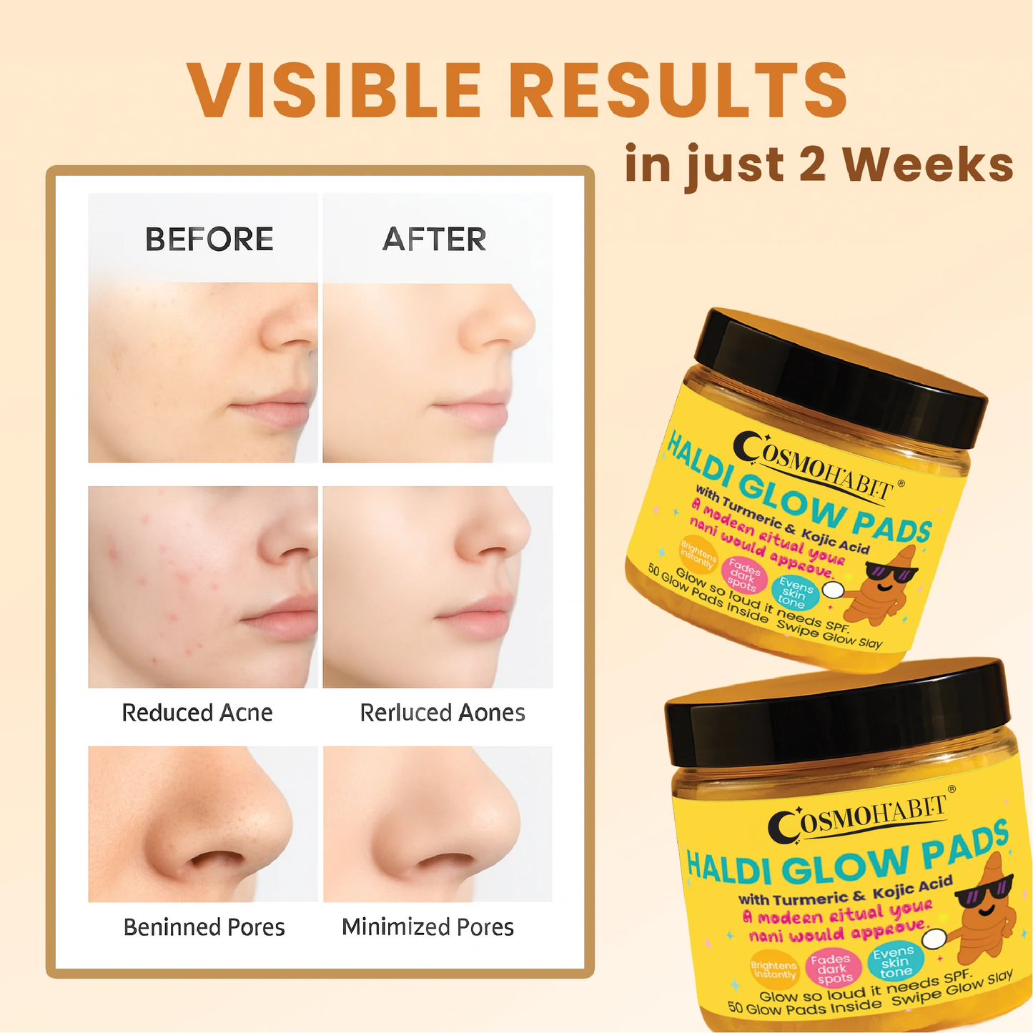 Turmeric Kojic Acid Pads My Store