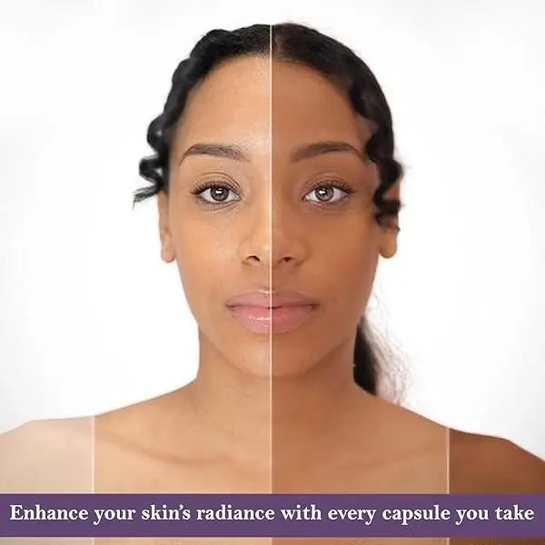 Glutathione Capsules For Skin Whitening My Store
