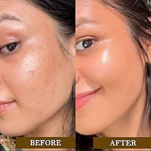 Multani Mitti Powder My Store