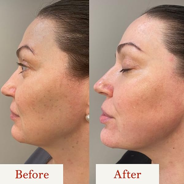 Vitamin C Facewash | Brighter, Healthier Skin by Reducing Dark Spots My Store