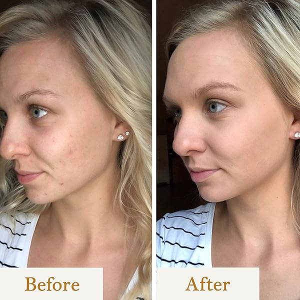 Vitamin C Cleanser | Combating Environmental Damage My Store