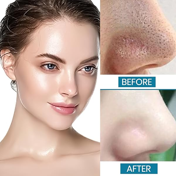 Pore Refining Face Toner | Prepare Skin for Moisturizers and Serums My Store