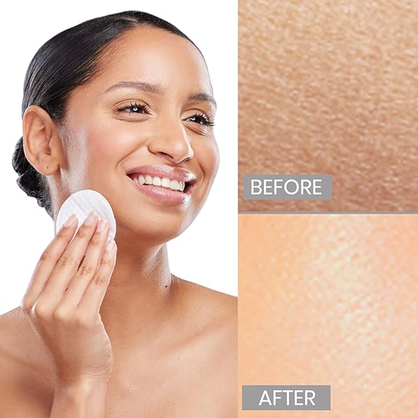 Rice Water Facial Cleanser | Improves Skin Tone & Removes Dead Cells My Store