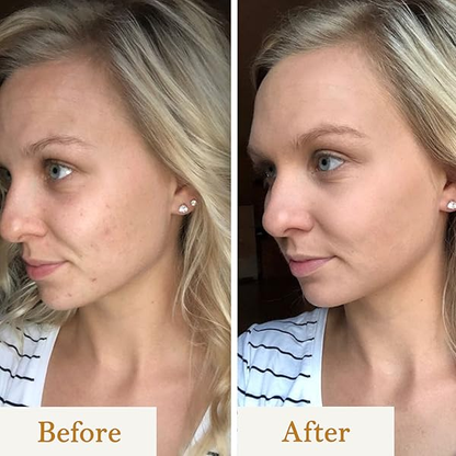 Vitamin C Cleanser | Combating Environmental Damage My Store