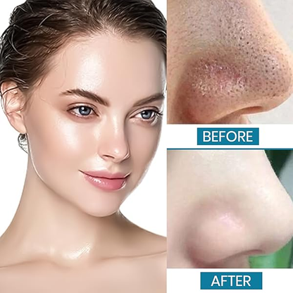 Pore Refining Face Toner | Prepare Skin for Moisturizers and Serums My Store